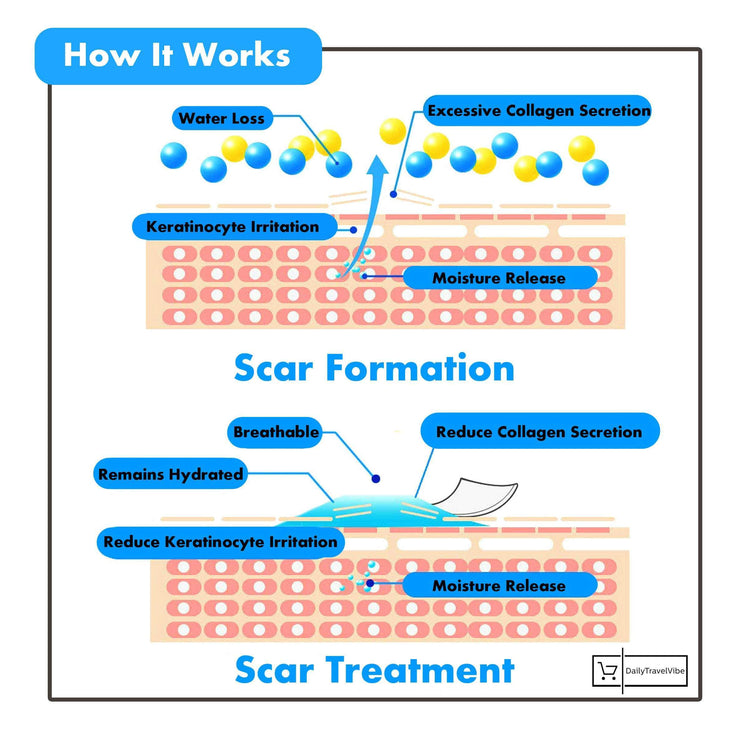 Miracle Stretch Mark + Scar Removal Sheets