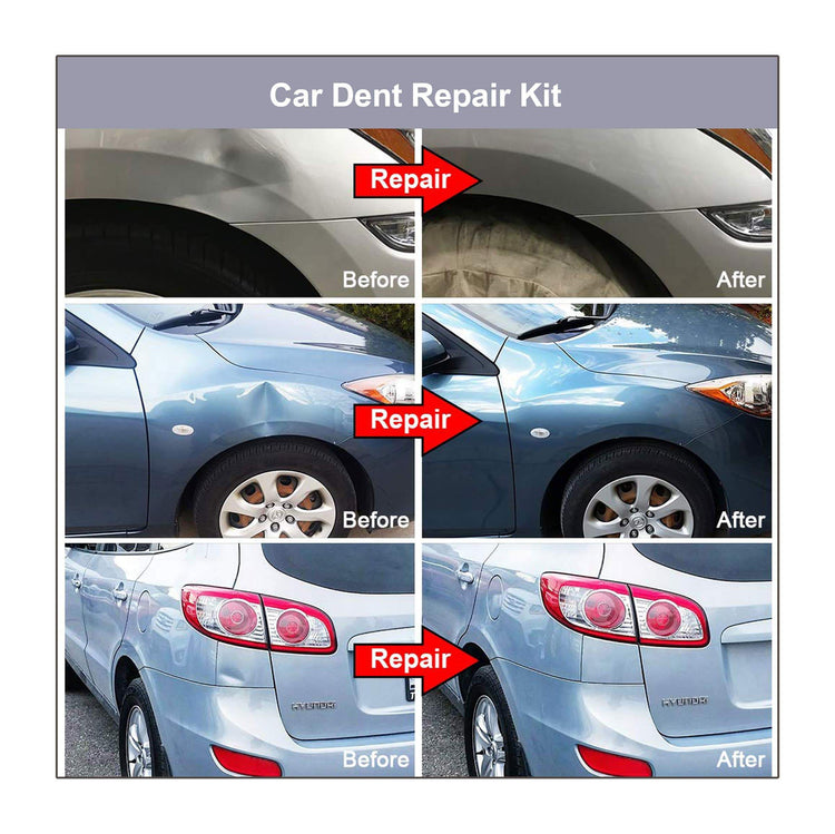 Car Dent Repair Kit