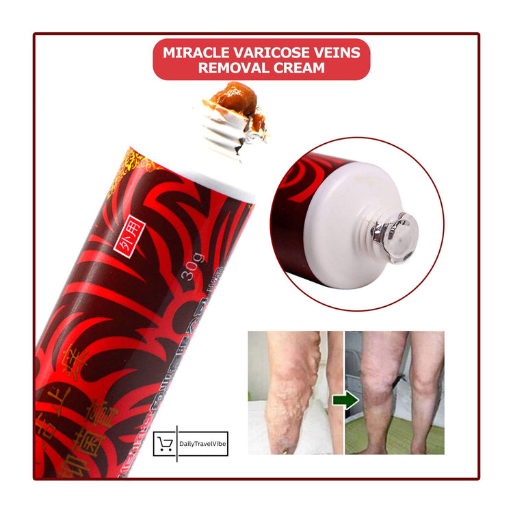 Miracle Varicose Veins Removal Cream