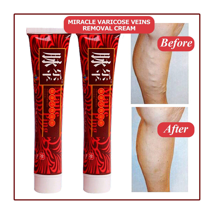 Miracle Varicose Veins Removal Cream