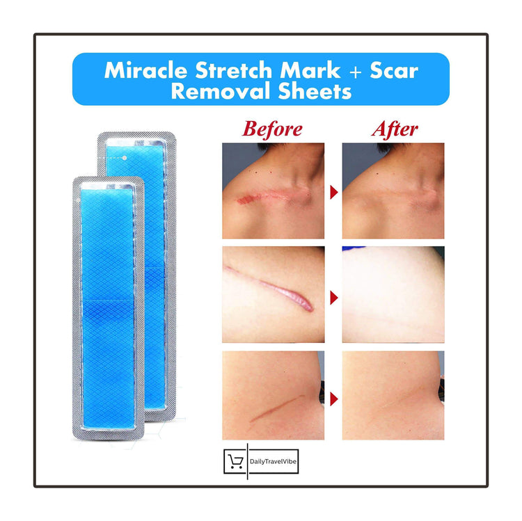 Miracle Stretch Mark + Scar Removal Sheets