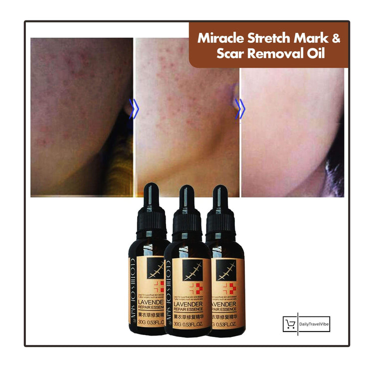 Miracle Stretch Mark & Scar Removal Oil