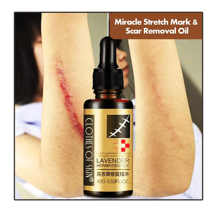 Miracle Stretch Mark & Scar Removal Oil