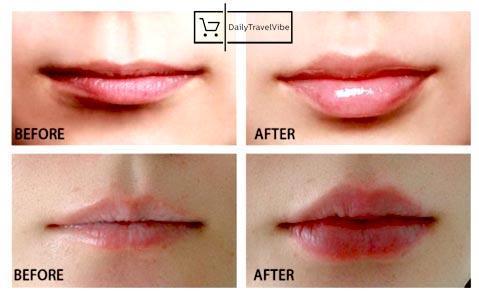 Miracle Lip Plumper