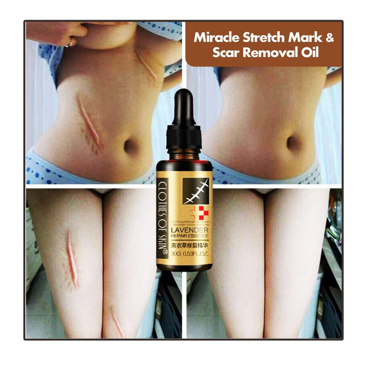 Miracle Stretch Mark & Scar Removal Oil