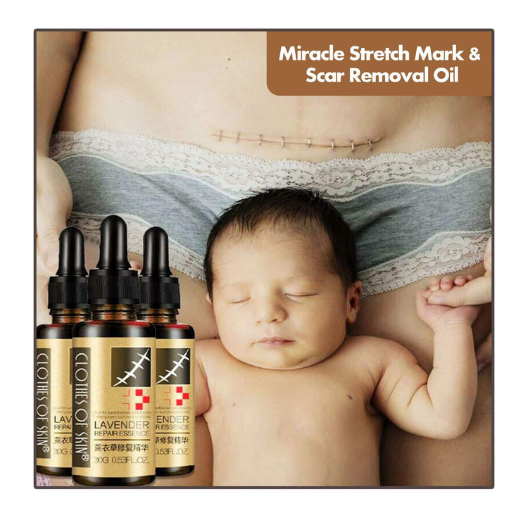 Miracle Stretch Mark & Scar Removal Oil