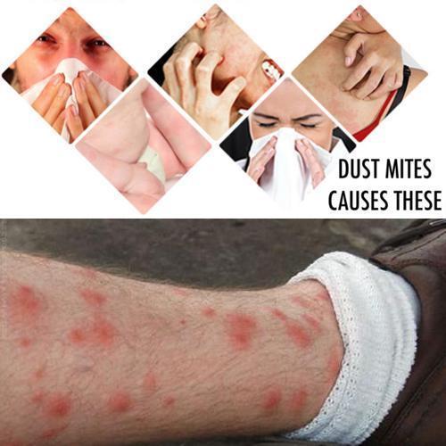 Super Dust Mite Killing Pad