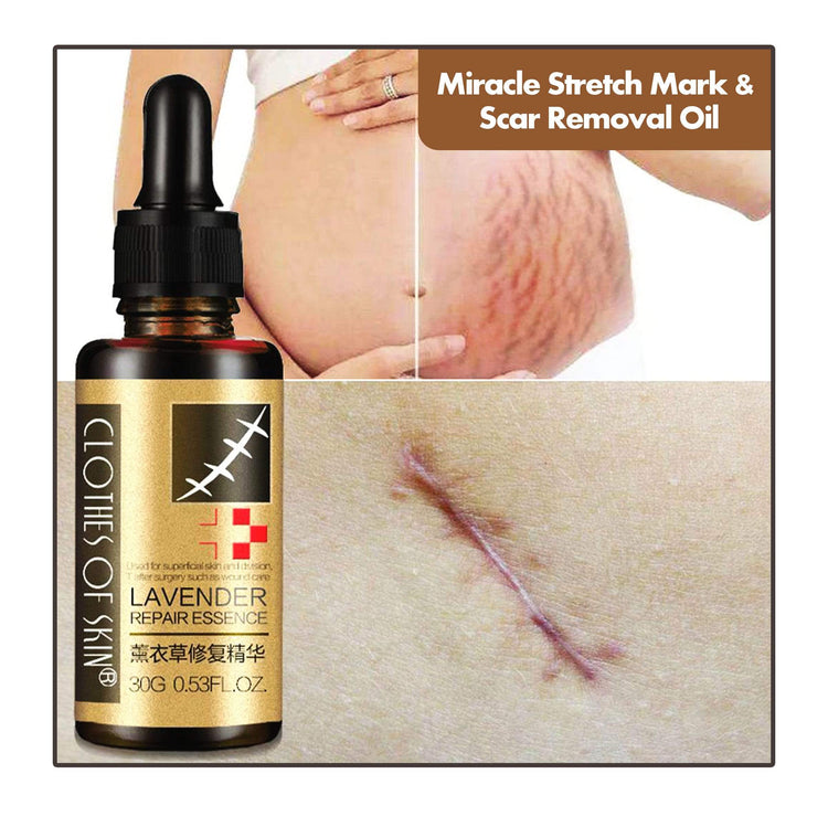 Miracle Stretch Mark & Scar Removal Oil