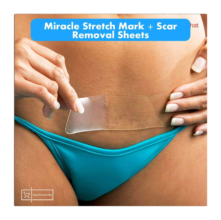 Miracle Stretch Mark + Scar Removal Sheets