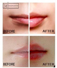 Miracle Lip Plumper