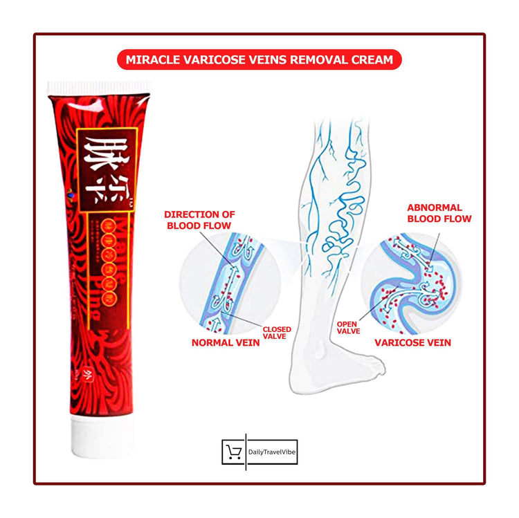 Miracle Varicose Veins Removal Cream