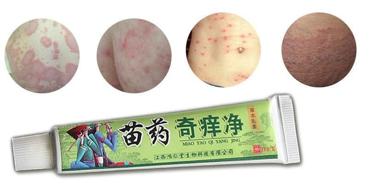 Miracle Psoriasis Removal Cream