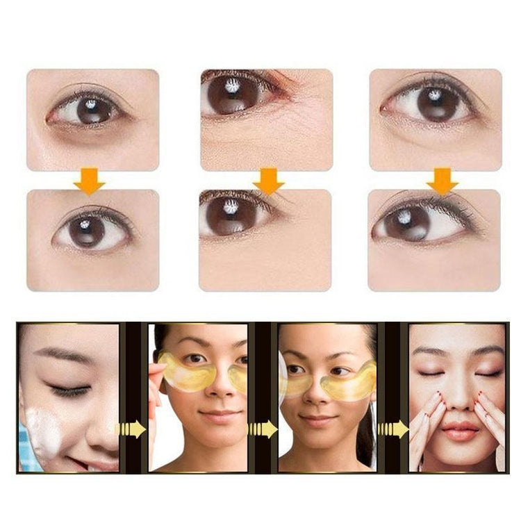 Eye Gel For Dark Circles (5 Pcs/Set)