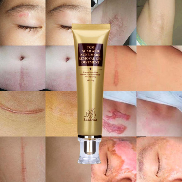 Miracle Acne Scar Cream