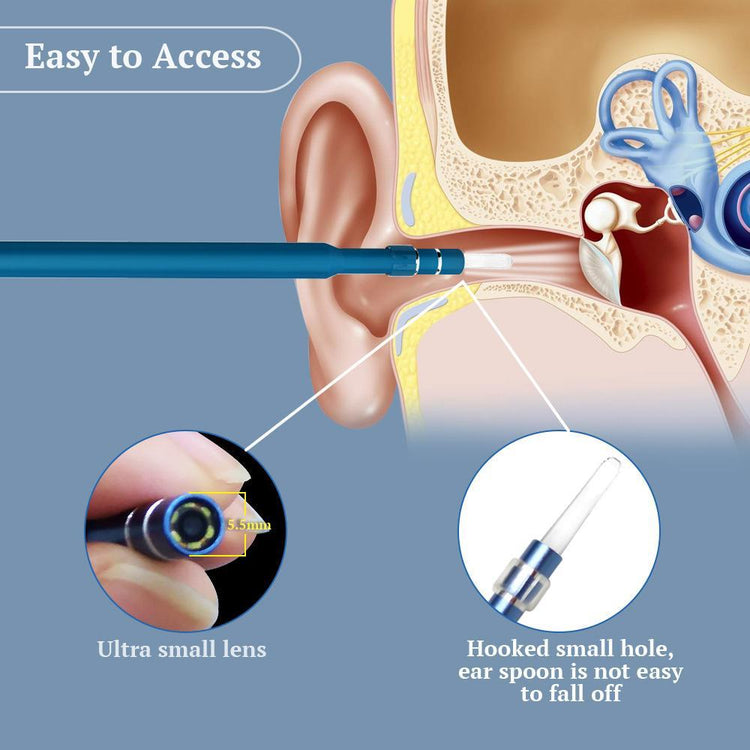 USB Endoscope Ear Wax Cleaner