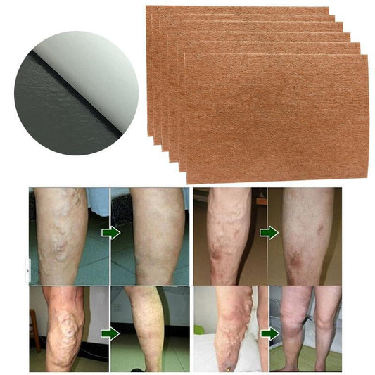 Varicose Veins Plaster Treatment (9 Pieces/Set)